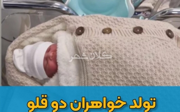 تولد خواهران دو قلو در «روزِ رشت»/عکس