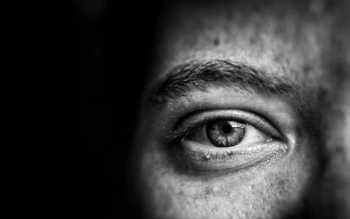 آیا می دانید چشم ها هم ممکن است درگیر سرطان شوند؟