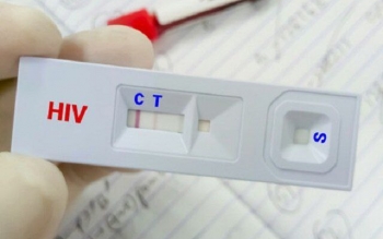 درمان «ایدز» رایگان است/ ویروس HIV قابل کنترل است به شرط درمان