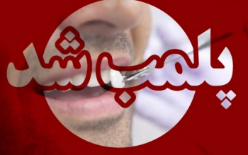 پلمب مطب دندانپزشک قلابی در بلوار افتخاری رشت هنگام کامپوزیت یک مراجعه کننده