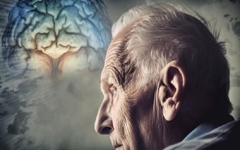 نتایج شگفت‌انگیز یک تحقیق؛ دارویی که از آلزایمر پیشگیری می‌کند