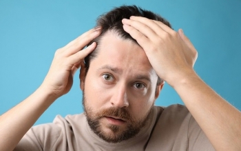 چهار توصیه مهم برای کسانی که ریزش مو دارند