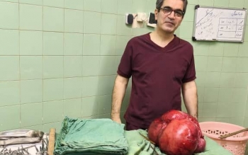 خارج کردن توده ۱۰ کیلوگرمی از شکم بیمار  ۴۸ ساله