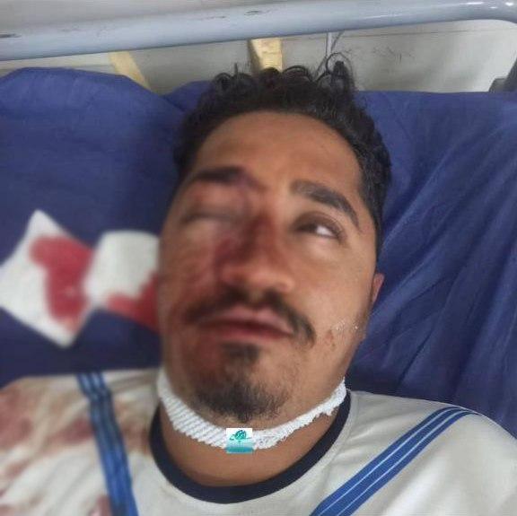 خطر از دست دادن بینایی هوادار ملوان با سنگ پرتاب شده‌ طرفداراستقلال