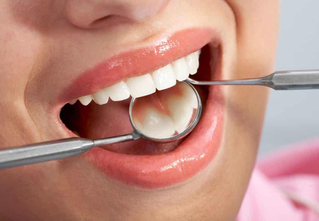 وضعیت خدمات دندانپزشکی کشور نگران‌کننده است