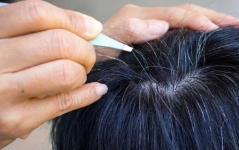 آیا می‌توان جلوی سفید شدن موها را گرفت؟/ دلیل سفیدی مو در نواحی شقیقه‌ها