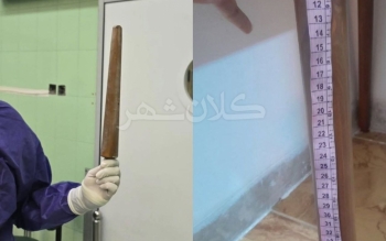 متهمِ تجاوز به پسربچه در تبریز پس از انتقام خانواده با پایه مبل درگذشت