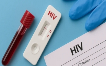 تغییر الگوی انتقال HIV در ایران: از سرنگ مشترک به روابط جنسی پرخطر