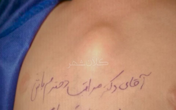 یادداشت یک مادر روی سینه دختر چهارساله‌اش