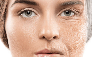 چگونه با افزایش سن از «پروتئین نگهدارنده بدن» مراقبت کنیم؟
